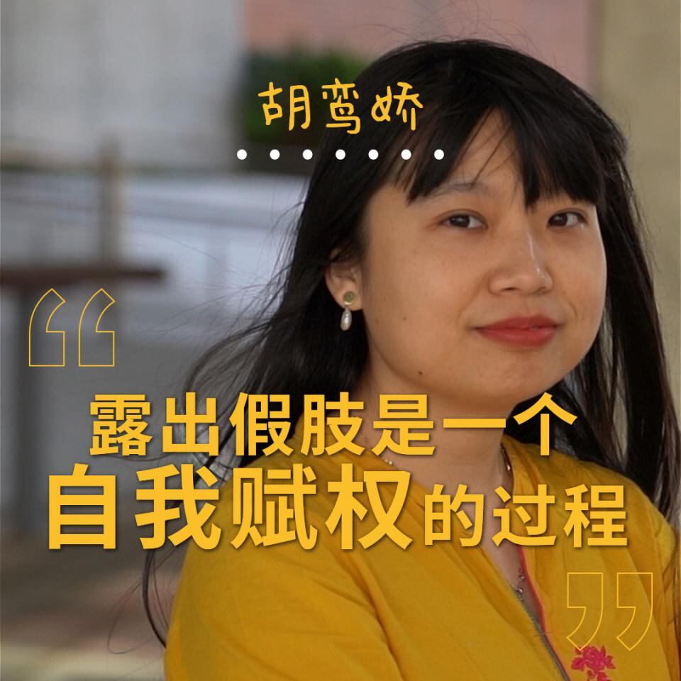 胡鸾娇:露出假肢是一个自我赋权的过程